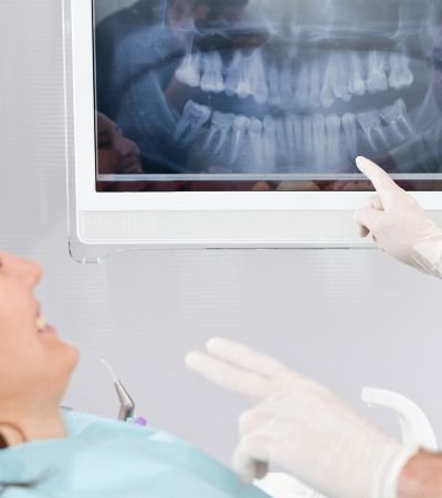 X-rays